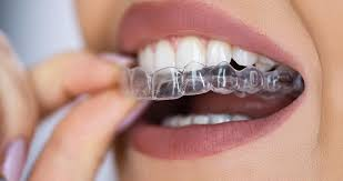 image 17 Invisalign in Westwood A Modern Solution for Straightening Your Teeth